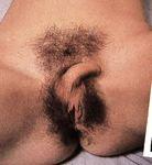 Коллекция порно фото настоящих гермафродитов